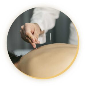 Especialidades Clinica Gandra: Acupuntura